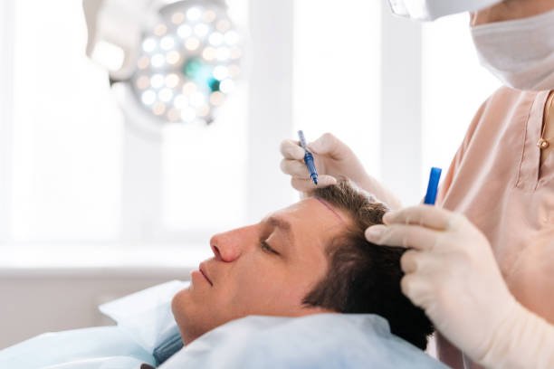 How Safe is Hair Transplant in Riyadh? Understanding the Risks and Precautions